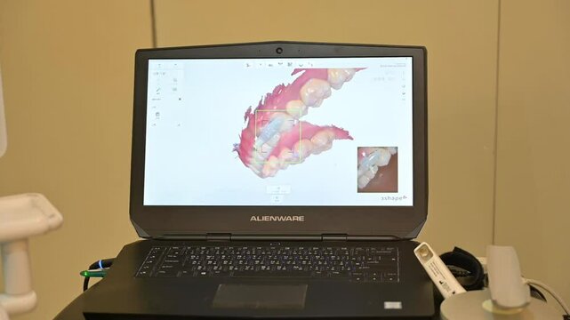 A dental CAD and CAM design screen,which provides the necessary graphics processing power for complex 3D dental modeling.