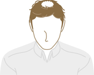 AGA：正面から見た薄毛の若い男性（俯瞰）