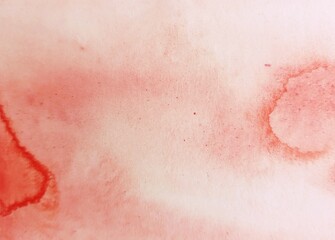 close up of a skin of a patient