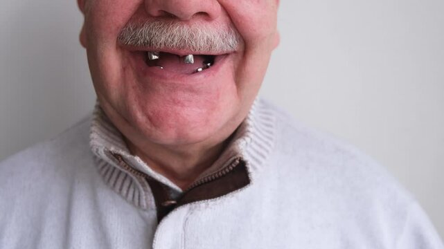 A toothless smile on an elderly man. preparation for prosthetics
