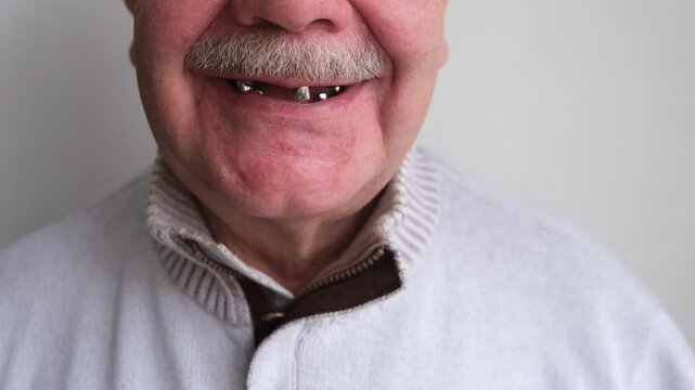 A toothless smile on an elderly man. preparation for prosthetics
