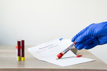 A physician holds an MPXV, monkeypox test tube in his glove over the daily infected report. Next to more laboratory test vials of human blood. white background with copy space.