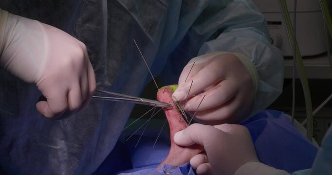 The surgeon bends the pins to create a strong structure that holds the dog's broken bone in the correct position. Surgery to restore a broken limb in a dog using osteosynthesis.