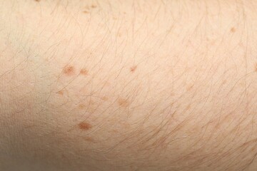 Texture of normal skin as background, closeup