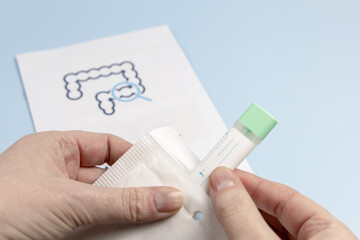 Rectal cancer screening test for home use and lab delivery