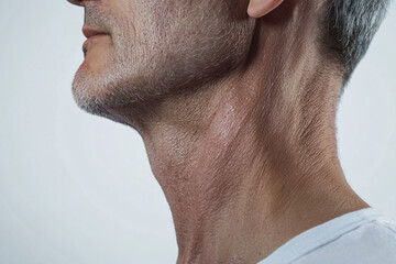 Obraz premium aged male neck close-up showing sun damage