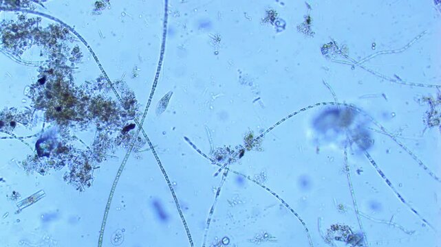 Freshwater protozoan and algae under microscope - 100X