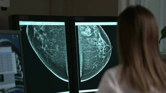 A radiologist is tasked with evaluating mammogram images for ensuring optimal breast health