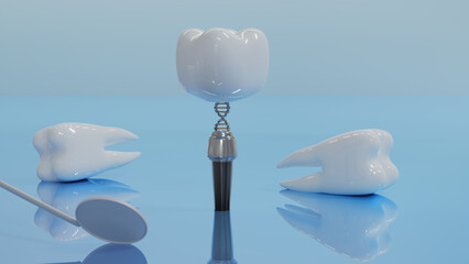 Dental Implants surgery concept, dentistry denture, Dental denture on blue background. 3D render. 