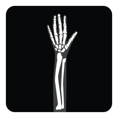 X-ray film hand and fingers