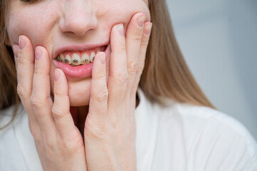 Close-up portrait of a red-haired girl suffering from pain due to braces. Young woman corrects bite with orthodontic appliance.