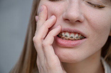 Close-up portrait of a red-haired girl suffering from pain due to braces. Young woman corrects bite...