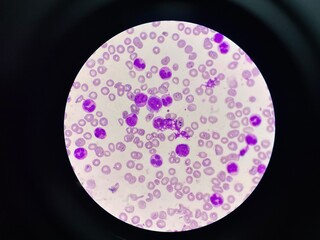 White blood cell
