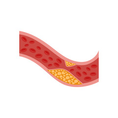 High Cholesterol, Cardiovascular Disease Illustration Icon