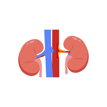 Renal Artery Stenosis, Cardiovascular Disease Illustration Icon