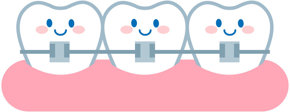 dental braces