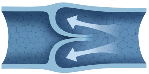 Diagram of venous valves, these are internal structures in the veins that prevent blood from flowing backward, ensuring its unidirectional flow towards the heart.