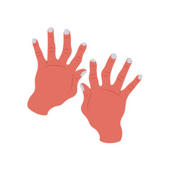 Arthritis, Hand, Disability Vector Illustration Isolated