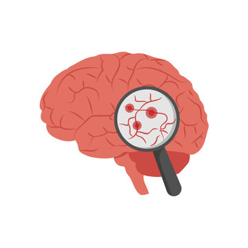 Dementia, Disability Vector Illustration Isolated