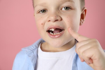 Cute little boy pointing at his missing tooth on pink background, closeup