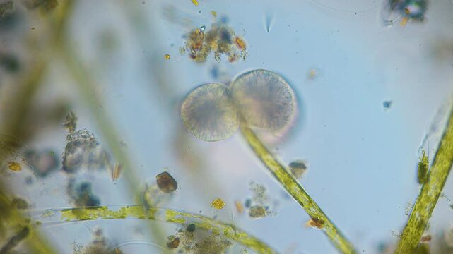 The amazing world of microbiology. Different bacteria, microbes and single-celled microorganisms are visible through a microscope. High-quality video.