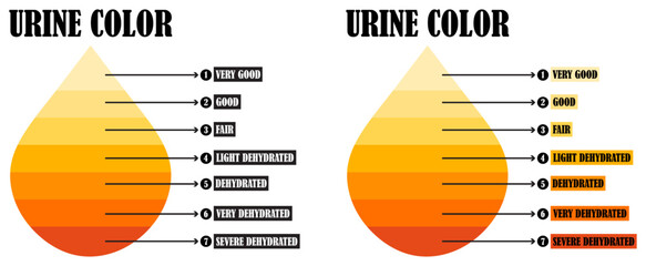 Urine color chart hydration dehydration scale health monitoring guide. Urine samples. Urine Color scale chart. Scale to analyse the hydration of a patient based in the urine color. Urine color chart. 