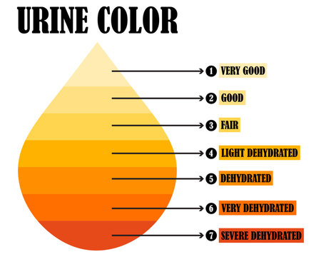 Urine color chart icon set collection. Urine color chart hydration dehydration levels health assessment gradient scale.  Urine color chart hydration levels dehydration health guide. urine chart.