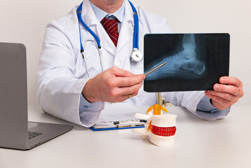 Orthopedic doctor show x-ray radiography. Fracture of the leg or foot. Concept of rehabilitation...