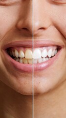 Before and after teeth whitening results showcasing a bright smile transformation