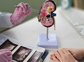 A doctor demonstrates the anatomy of the kidney using a model during a consultation with a patient