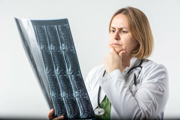 Confident female doctor examines an MRI scan of a patient's spine in her office. She carefully analyzes the results to assess the patient’s condition and plan the next steps in treatment.