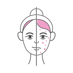 Minimalist before and after skincare illustration in a modern, thin-line style with pink accents. Ideal for beauty, skincare branding