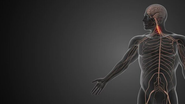 Cervical Radiculopathy Impacting Neck and Arm Nerves