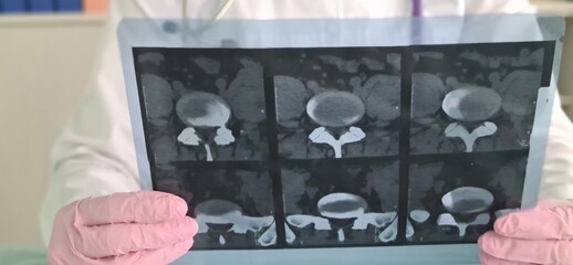 Female doctor examines an x-ray in clinic closeup
