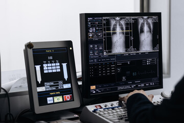 In Control Room Doctor and Radiologist Discuss Diagnosis while Watching Procedure and Monitors...