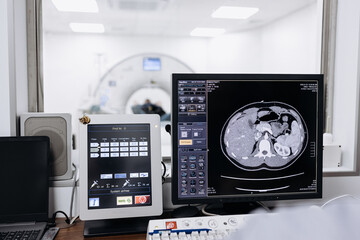 Doctor examining X-ray images on display in MRI control room while in background nurse preparing the patient for examination test. Medicine concept
