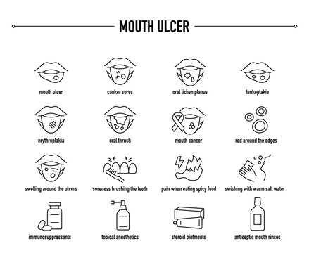 Mouth Ulcer symptoms, diagnostic and treatment vector icon set. Line editable medical icons