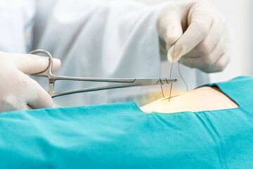 Doctor hand wear sterile gloves and surgery scissor stitching up wound after surgery.Plastic surgeon placing sutures after plastic surgery in operating room.Nurse teaches the technique of suturing.