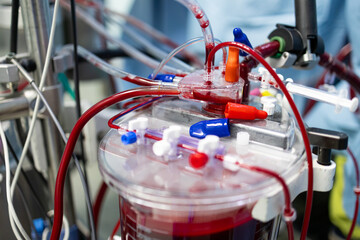 Cardiopulmonary Bypass Machine, Blood reservoir during heart surgery, saving lives in the operating...