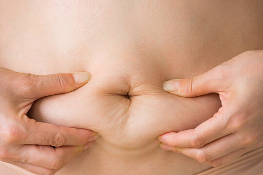 woman squeezes her belly fat