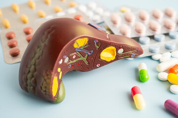 Liver model with pill drug treatment, Cirrhosis, Liver cancer, fatty liver.