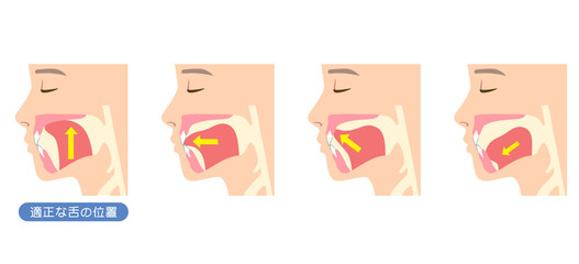 正しいミューイングの方法　適正な舌の位置と誤った舌の位置 © koti