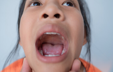 little girl open mouth for checkup oral hygiene.