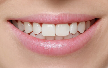 Young woman with healthy teeth and beautiful smile, closeup