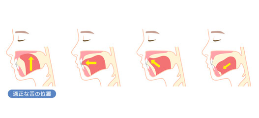 正しいミューイングの方法　適正な舌の位置と誤った舌の位置 © koti