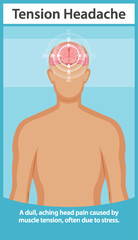 Understanding Tension Headaches and Stress