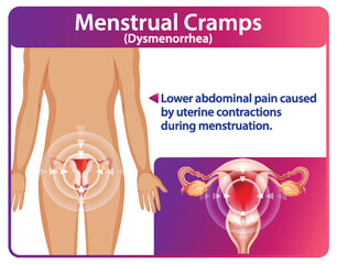 Obraz premium Understanding Menstrual Cramps and Dysmenorrhea