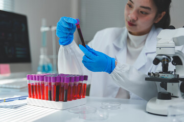 Medical professional wearing lab coat and gloves carefully examines blood sample in test tube,...