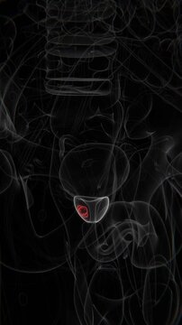 Close up of cancer in prostate area in Vertical X-Ray Video | Prostate Cancer Indication in Vertical X-Ray HD Video
