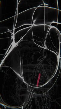 3D Medical Illustration Of Coronary Stent Placement | Coronary Stent Video | Artery Stent Video | Xray Video in HD